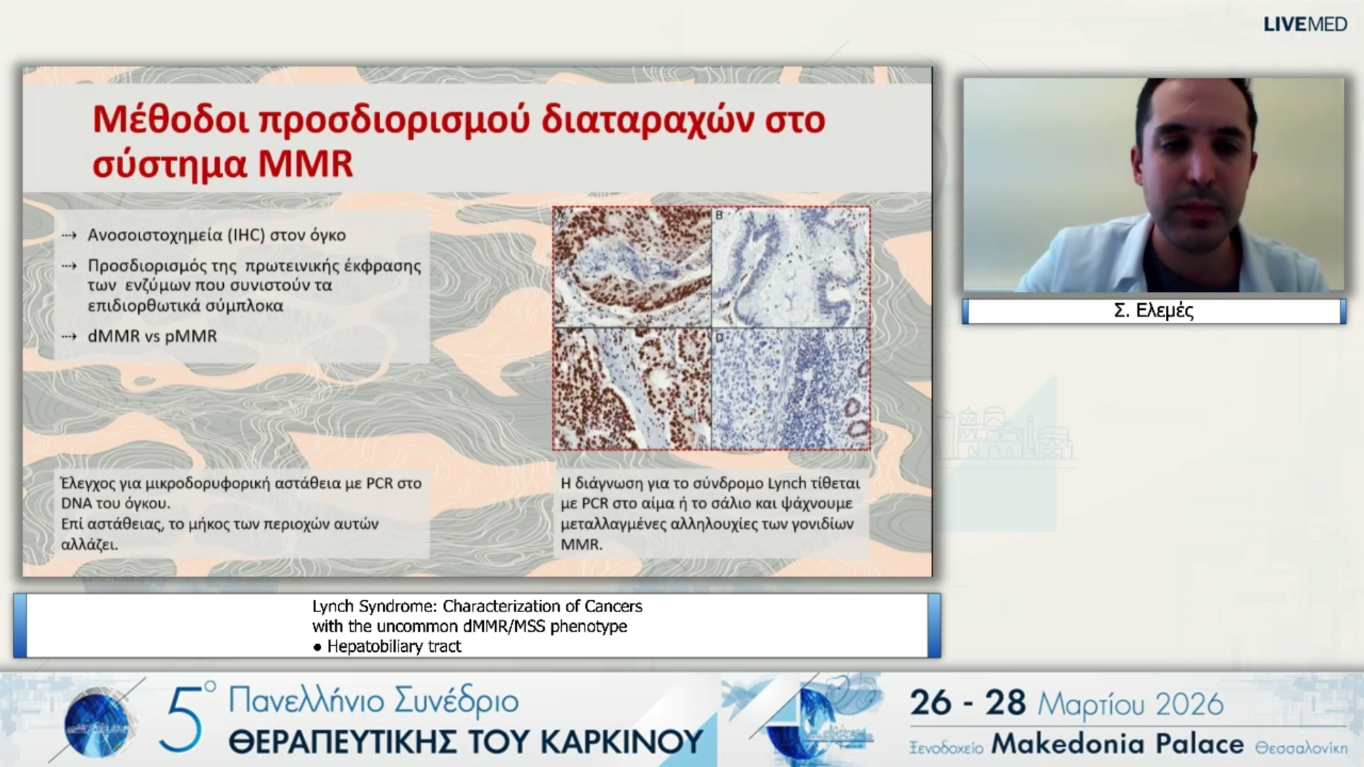 05 Σ. Ελεμές - Lynch Syndrome: Characterization of Cancers with the uncommon dMMR/MSS phenotype ● Hepatobiliary tract 