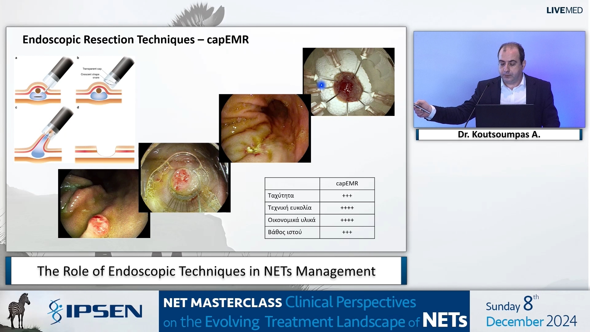 04 Dr. Koutsoumpas A. - The Role of Endoscopic Techniques in NETs Management