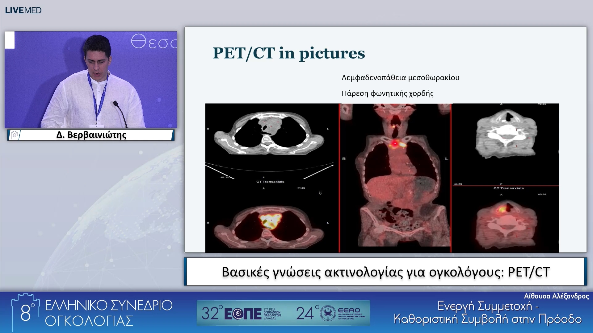 009 Δ. Βερβαινιώτης - PET/CT. 