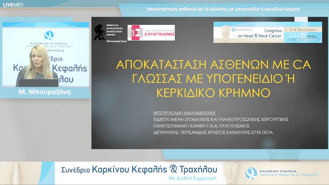11 Μ. Μπουραζάνη - Αποκατάσταση ασθενών με Ca γλώσσας με υπογενείδιο ή κερκιδικό κρημνό 