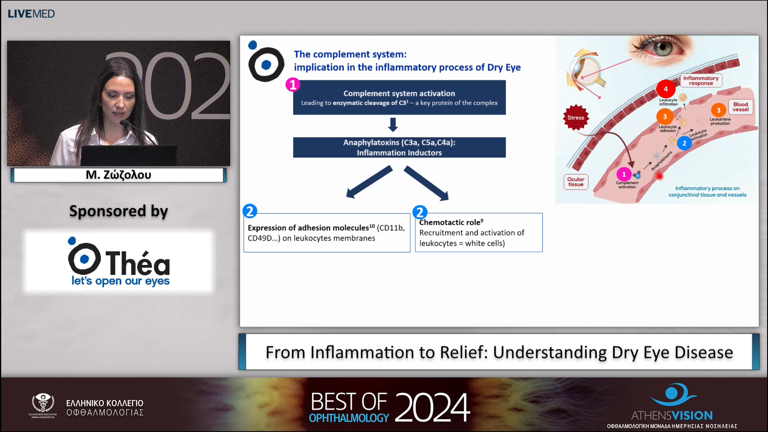 20 Μ. Ζώζολου - From Inflammation to Relief: Understanding Dry Eye Disease 