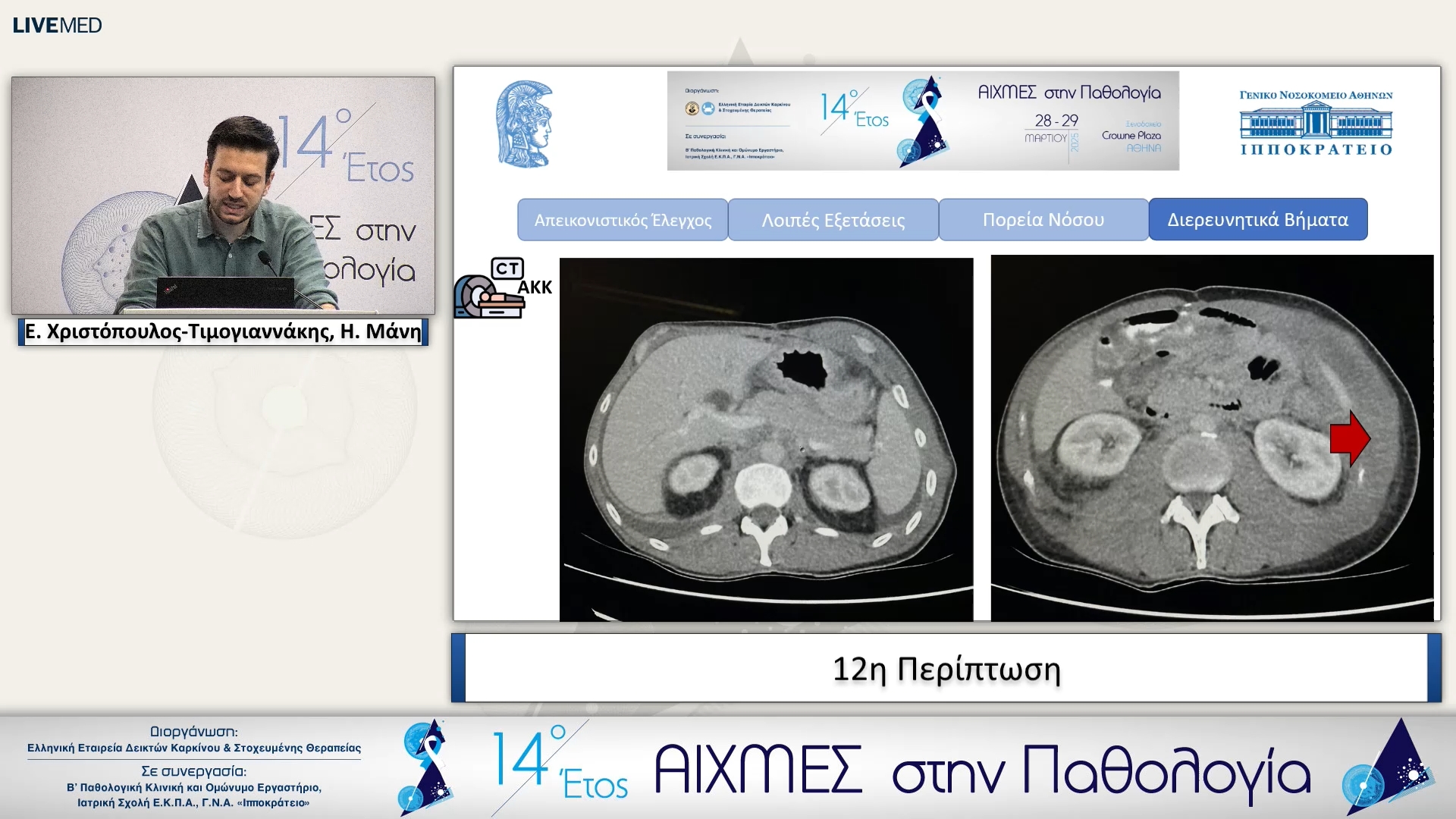 12 Ε. Χριστόπουλος-Τιμογιαννάκης - 12η Περίπτωση