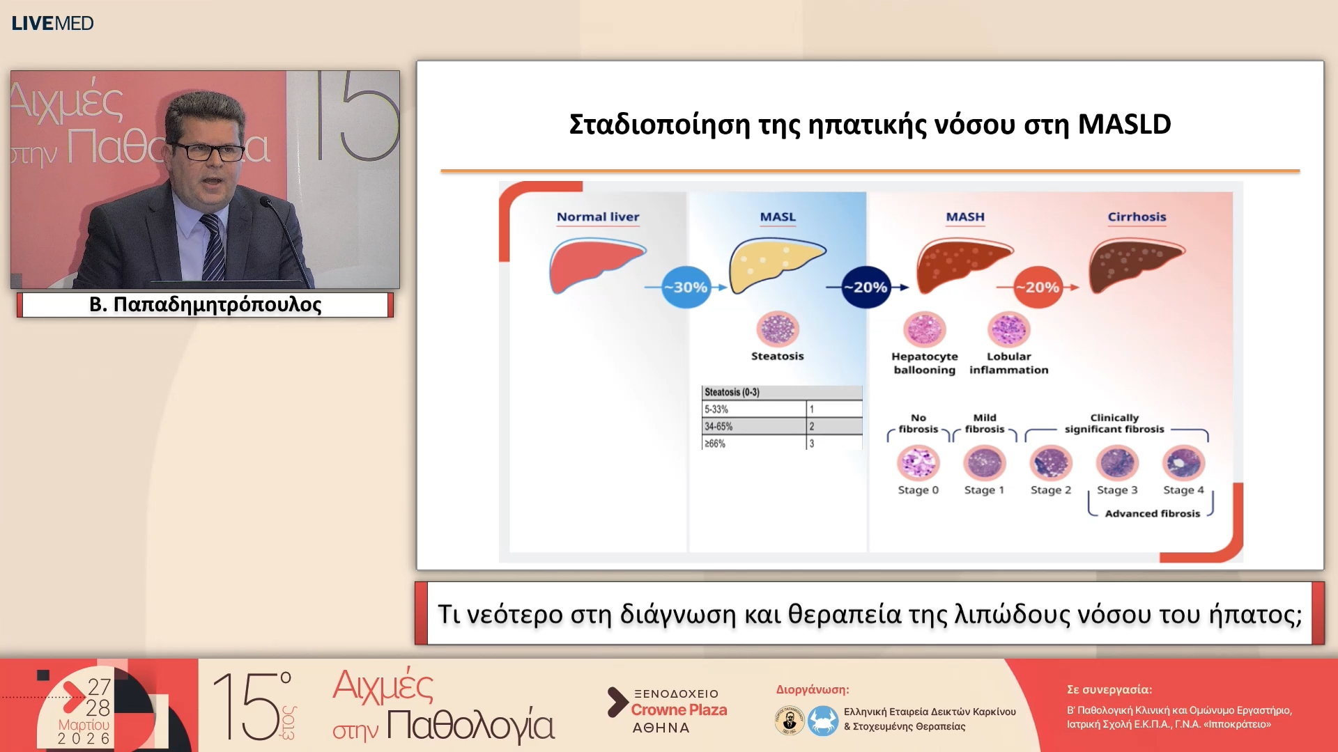 61 Β. Παπαδημητρόπουλος - Τι νεότερο στη διάγνωση και θεραπεία της λιπώδους νόσου του ήπατος;