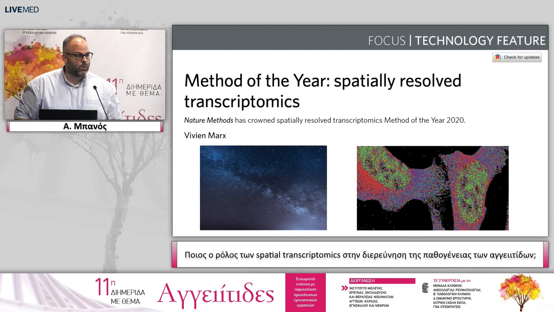13 Α. Μπανός - Ποιος ο ρόλος των spatial transcriptomics στην διερεύνηση της παθογένειας των αγγειιτίδων; 